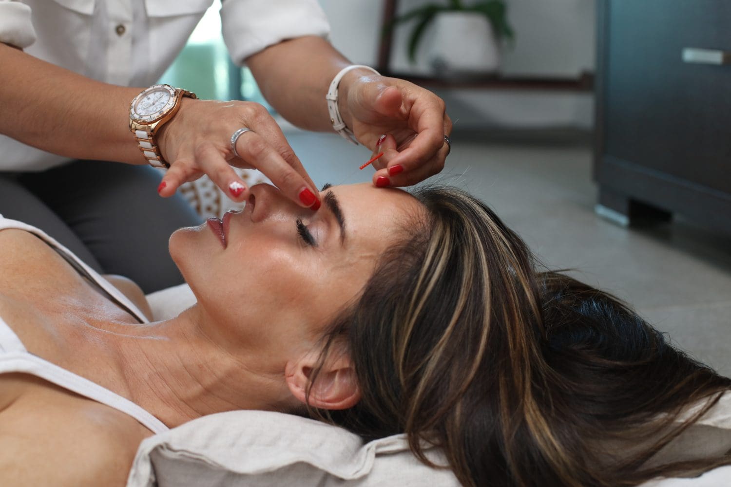 Woman receiving facial rejuvenation acupuncture